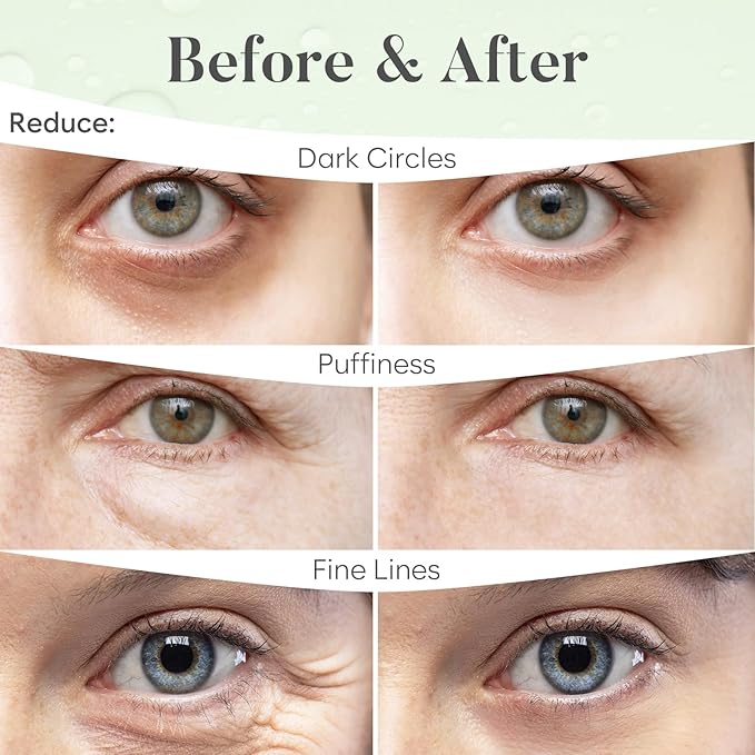 BLOOMORA Green Tea Under Eye Patches (30 Pairs) - For Dark Circles & Puffiness - Hydrating Green Tea Eye Mask