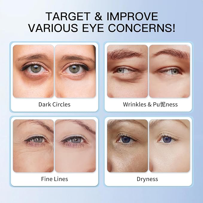 Eye Cream for Dark Circles: Anti Aging Caffeine & Retinol Eye Cream, Moisturizing Serum for Puffiness, Bags and Fine Lines, UnderEye Treatment for Women