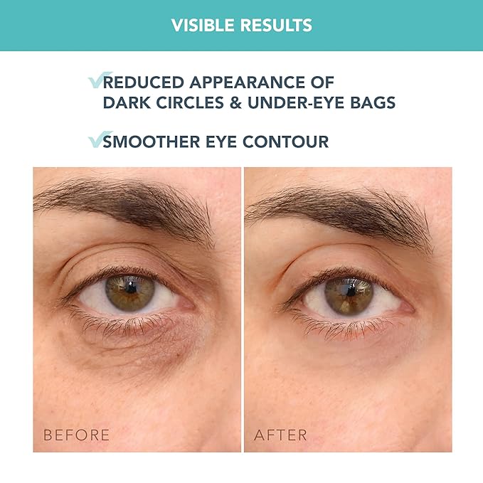 FOREO IRIS C-Concentrated Brightening Eye Cream for Dark Circles and Puffiness - Under Eye Brightener - Hyaluronic Acid - Antioxidant - Vegan - Travel Size - All Skin Types - 0.5 oz