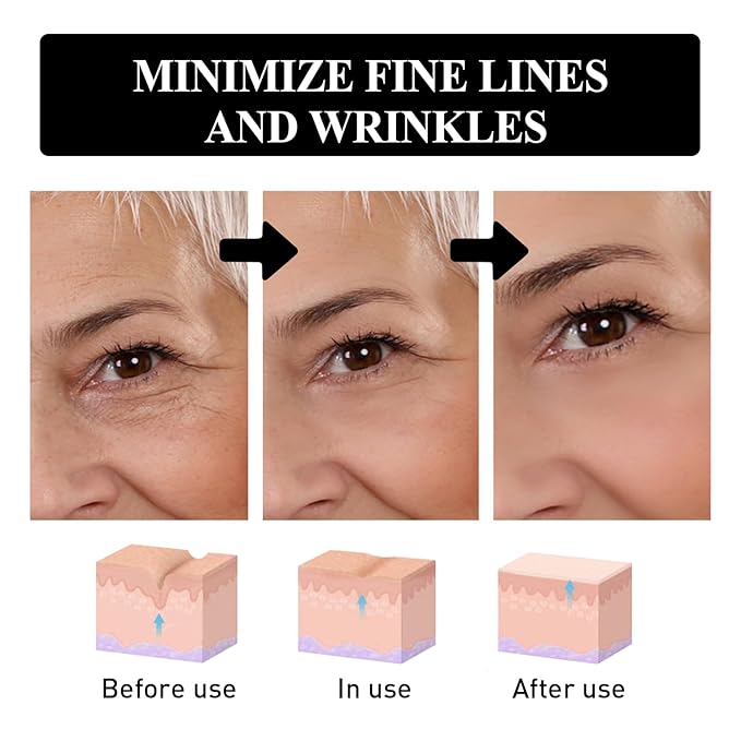 Snake Peptide Eye Cream，Anti-Aging Eye Cream for Dark Circles, Puffiness & Wrinkles, Hydrating Eye Treatment with Niacinamide & Glycerin (2)