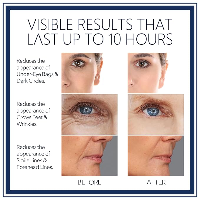 Rapid Reduction Eye Serum - Visibly Reduces Under-Eye Bags, Wrinkles, Dark Circles, Fine Lines & Crow's Feet Instantly, Facial Serum-10ML