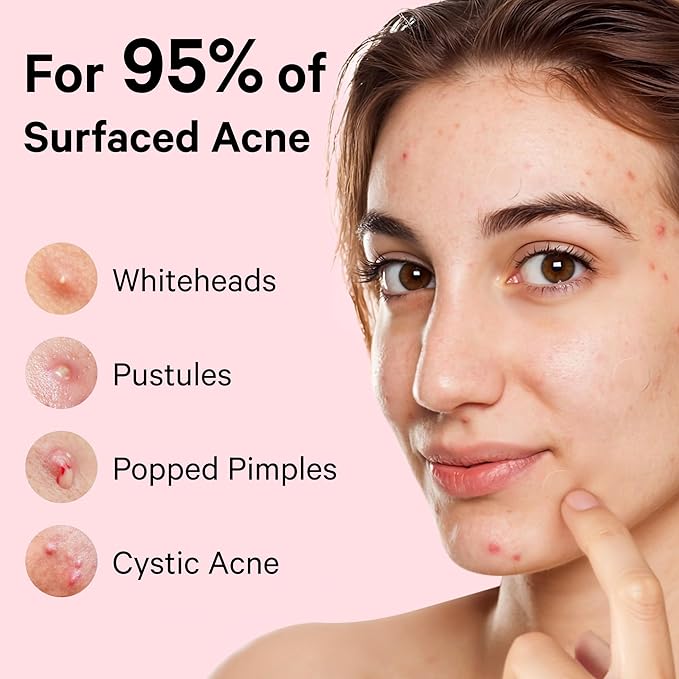 Sosky Pimple Patches for Face, FSA HSA Eligible Invisible Hydrocolloid Acne Patches, Zit Sticker for Face and Skin, Pimple Sticker for Covering Zits, Blemishes with Salicylic Acid 144 Count