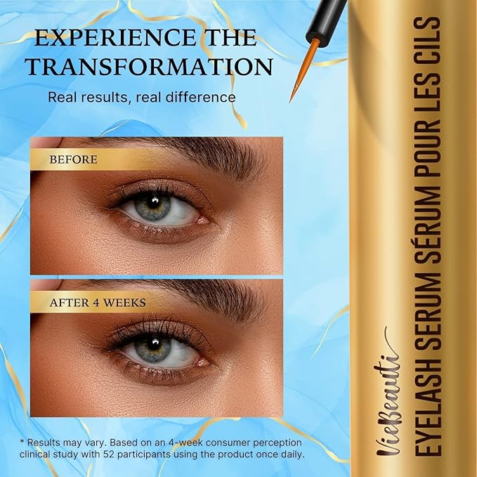 VieBeauti Eyelash Growth Serum 5mL – Lash Serum for Longer, Fuller & Thicker Looking Lashes, Advanced Nourishing Formula, Vegan & Cruelty-Free, Gentle for Sensitive Eyes