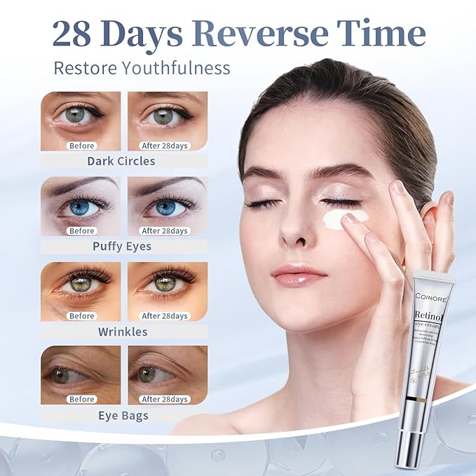Retinol Under Eye Cream - Anti-Aging Treatment for Dark Circles, Puffiness & Wrinkles, Gentle Formula for Men & Women to Reduce Fine Lines, 0.7 Fl Oz