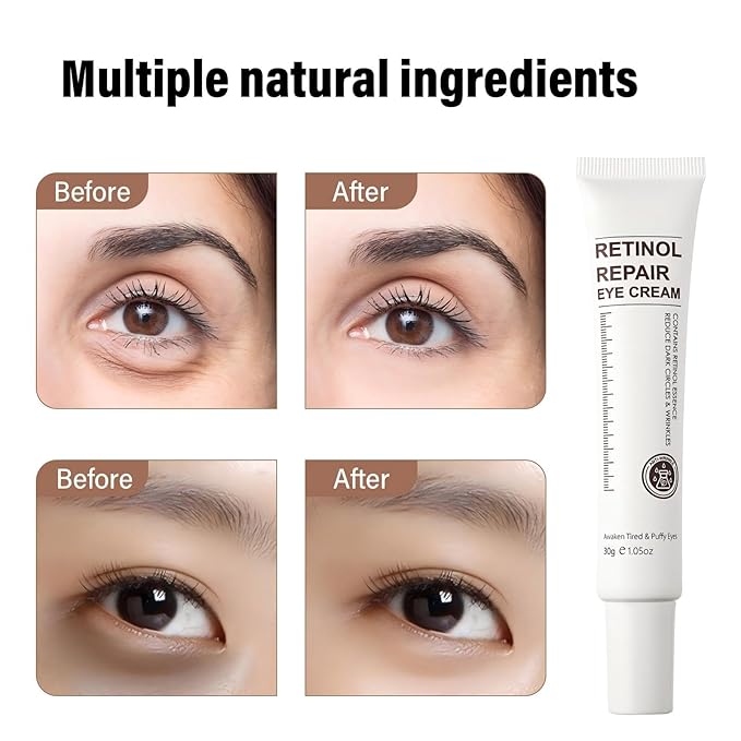 Retinol Eye Cream for Dark Circles and Puffiness – Eye Cream Anti Aging to Reduce Wrinkles & Fine Lines, Firm and Hydrate Under Eyes, Revitalizing Eye Treatment 30g/1oz