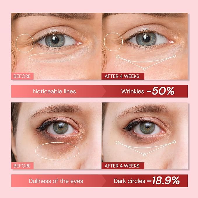 Retinol Eye Cream Anti Aging: Instant Eye Tightener & Wrinkle Repair Moisturizer - Under Eye Bags Treatment for Women - Peptide Eye Serum Reduce Dark Circles & Puffiness, 0.85 fl.oz
