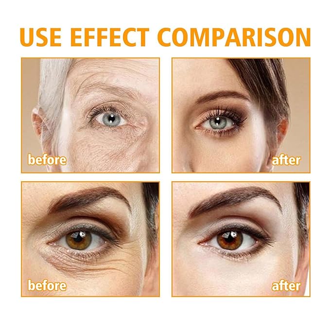 Beauty Crema De Ojos Con Péptidos 5D, Crema De Ojos Con Peptido 5D, Peptide Eye Cream, Eye Cream Anti Aging, For Dark Circles And Puffiness, Skin Under Eyes Moisturize (2PC)