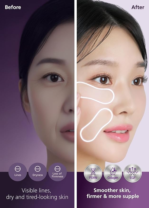 DWEasyDerm EasyDerm PDRN Patch – Under Eye & Smile Line Care, 4 Patches | K-Beauty Korean Skincare with Collagen & EGF, PDRN Eye Mask, Self-Care Essential