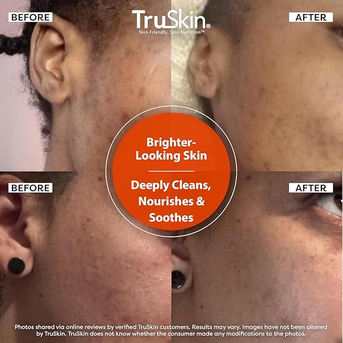 TruSkin Vitamin C Face Wash Cleanser - Brightening Facial Cleanser with Vitamins C & E, Rosehip Oil, Aloe Vera & MSM - Gently Cleanses, Refreshes & Supports Radiant Skin - 4 fl oz
