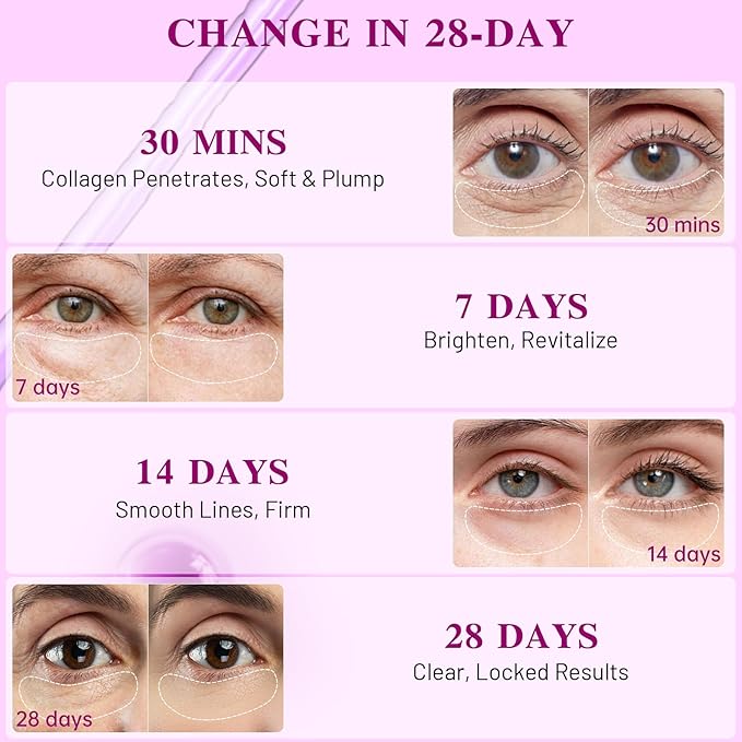 Under Eye Patches with Collagen, Eye Patches for Puffy Eyes and Dark Circles, 360° Under Eye Mask for Puffiness, Wrinkles, Fine Lines, Gifts for Women - Skin Care, 24 Pairs (White)