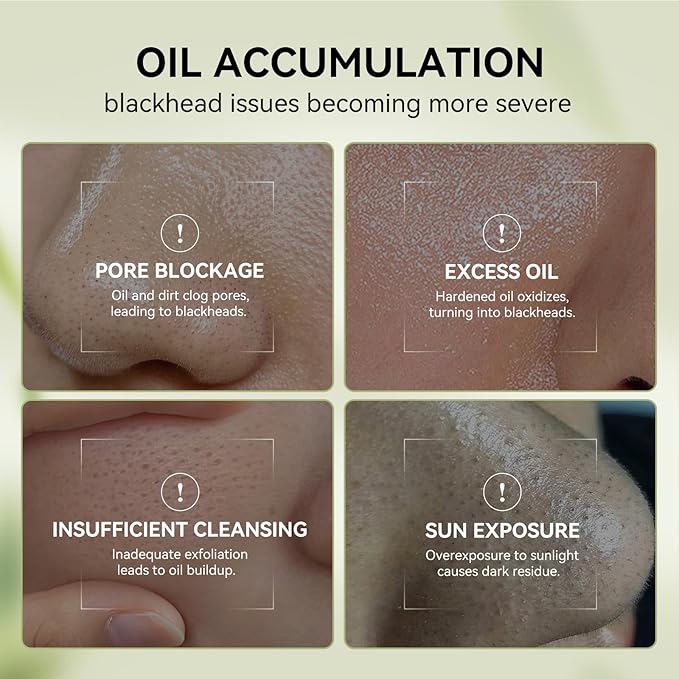 LANBENA 3 in 1 Blackhead Mask Kit-Bamboo Charcoal Pore Strips (30g), Pore Minimizing Serum (30ml) & Removal Paper - Mask for Face