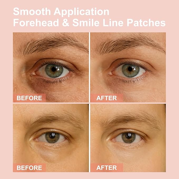 Micro Eye Patches, Deeply Hydrating Anti-Wrinkle Patches, Contains Hyaluronic Acid and Collagen for Dark Circles, Smooth Application Forehead & Smile Line Patches for Women (2)