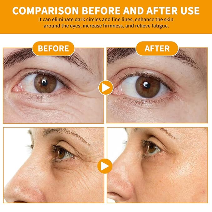 Vitamin C Eye Cream Puffiness Remover Serum Anti-aging & Moisturising Eye Bags Treatment for Men and Women