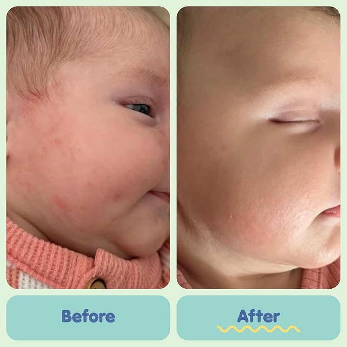 TUBBY TODD All Over Ointment - Baby Eczema Cream, Everyday Multi-Purpose Sensitive, Dry, Irritation Baby Skin Relief Cream, Steroid & Gluten Free, Lavender Rosemary - 1 Pack, 8 Oz