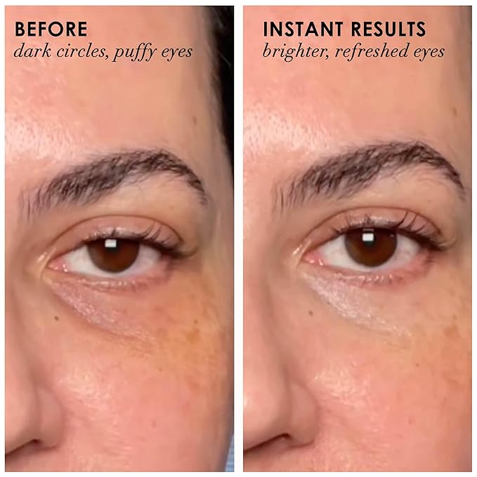 Dermelect Revitalite Eyelid & Dark Circle Corrector- Professional Strength, Anti-Aging Eye Cream with Peptides, Brightening & Tightening Ingredients- Dark Circles, Puffiness, Droopy Eyelids & Wrinkles