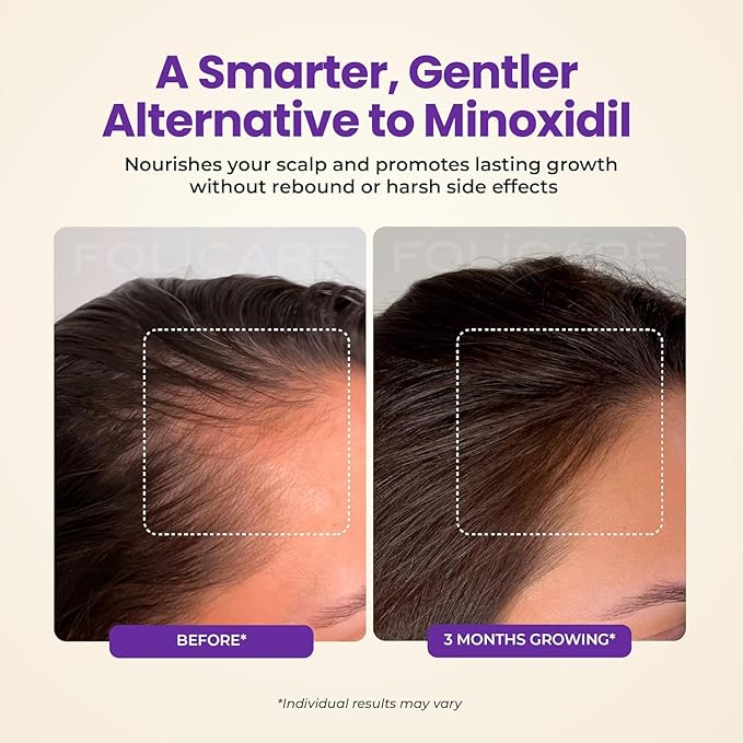 Hair Growth & Thickening Serum With Biotin & Rosemary + Multi-Benefit Treatment for Thinning Hair, Breakage & Split Ends, Boosts Density, Repairs Damage, Hydrates Dry Scalp - For Men and Women, 1 Pack
