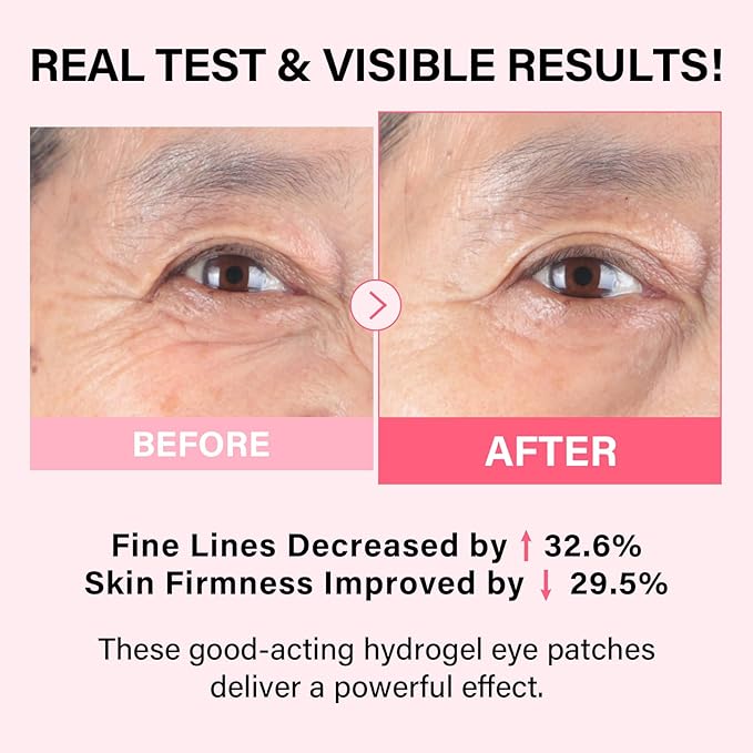 iMethod PDRN Collagen Boost Eye Patches - Under Eye Mask, Instant Lift Eye Mask for Reduce Fine Lines & Wrinkles, Firming Under Eye Patches for Dark Circles, Puffy Eyes, Eye Bags, 8 Pairs