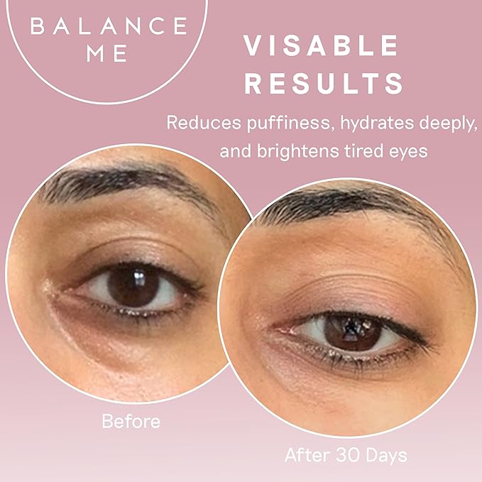 Balance Me Wonder Eye Cream, Dark Circles & Puffy Eyes Treatment with Hyaluronic Acid, Witch Hazel & Cucumber Oil, Anti-Aging, Anti-Wrinkle Eye Cream, (1 x 0.5 fl oz)