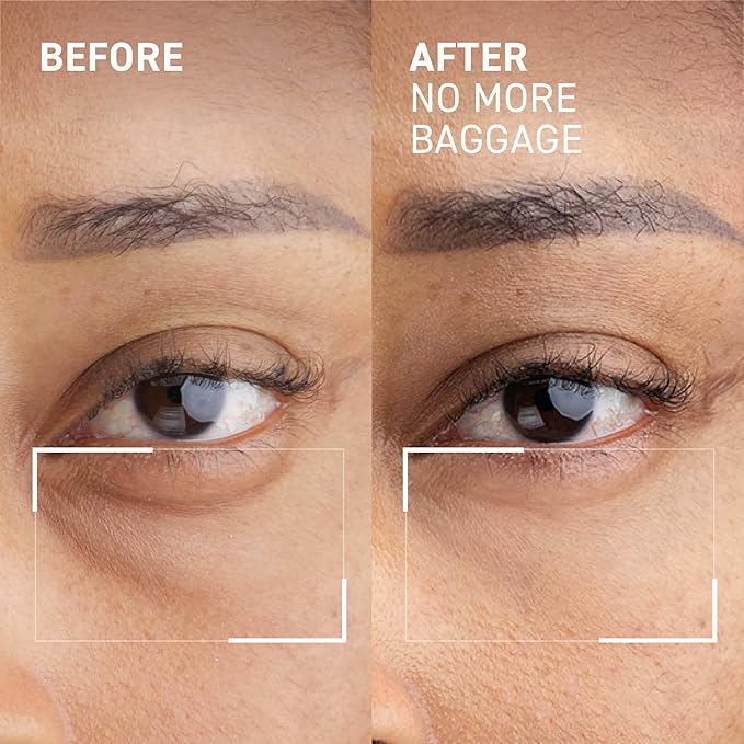 Dr. Brandt Needles No More, No More Baggage - 0.23 oz, Pack of 2 - Minimizes Under-Eye Bags, Puffiness & Dark Circles