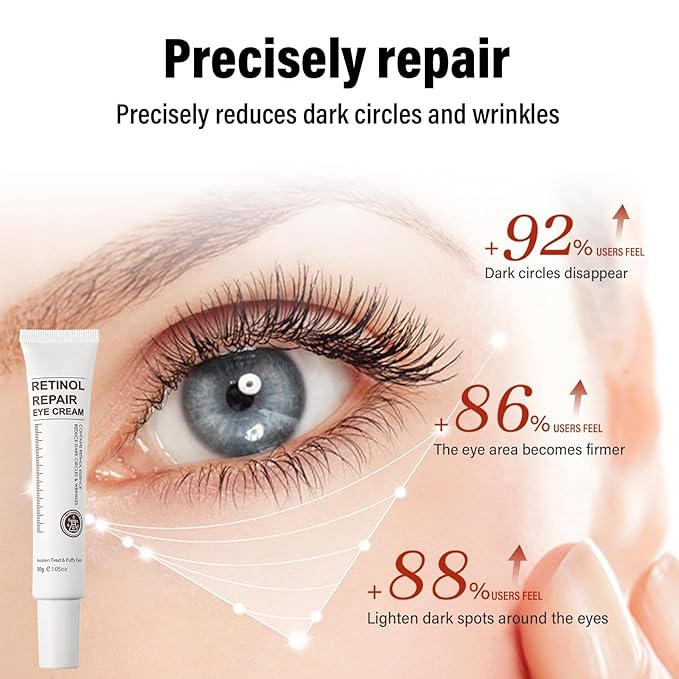 Retinol Eye Cream for Dark Circles and Puffiness – Eye Cream Anti Aging to Reduce Wrinkles & Fine Lines, Firm and Hydrate Under Eyes, Revitalizing Eye Treatment 30g/1oz