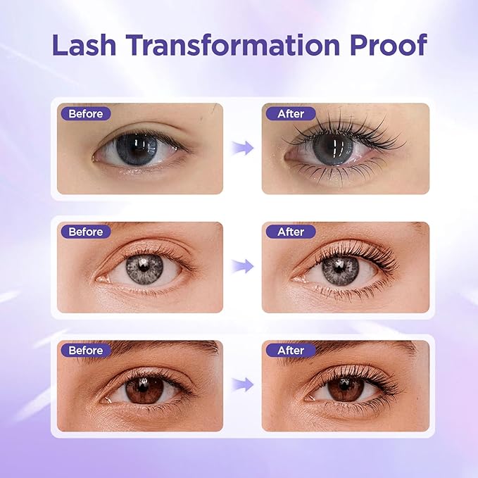 Lash Serum | Advanced Eyelash Growth Formula with Nourishing Botanical Extracts, Gentle Eye Treatment for Longer, Fuller & Thicker Natural Lashes, Vegan & Cruelty-Free