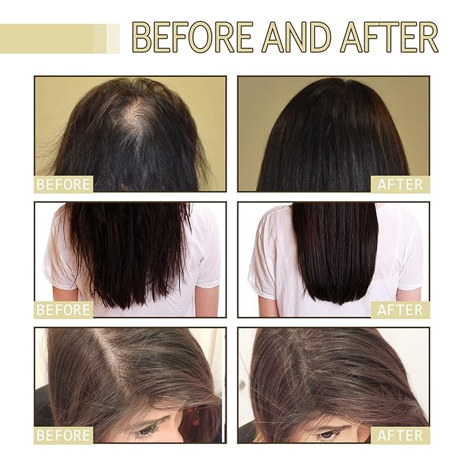Natural Hair Growth Oil for Dry, Damaged & Thin Hair, Nourishing Unisex Formula (3 * 60ml)