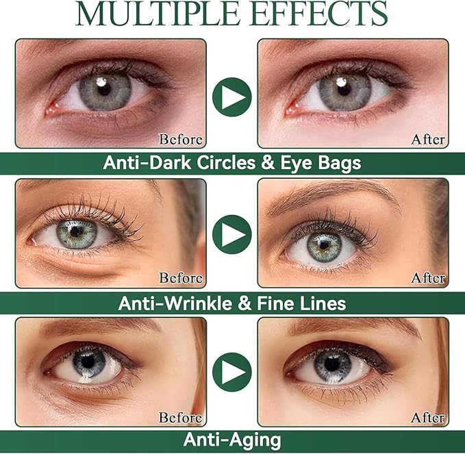 Avocado Eye Mask 60 PCS, Under Eye Patches for Dark Circles and Puffiness, Moisturizing Nourishing Eye Treatment Mask, Improving Eye Skin Dryness, Fine Lines and Wrinkles, Parches para Ojeras