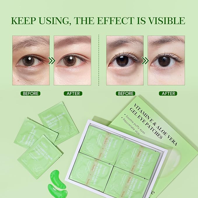 Yeokoe Under Eye Patches for Dark Circles,Puffy Eyes,20 Pairs Face Masks SkinCare With Vitamin E and Aloe Vera Gel for Rejuvenate