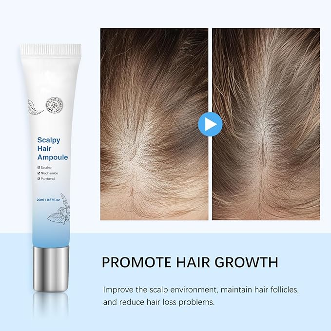 Scalp Serum for Hair Growth for Men & Women - Lightweight Scalpy Hair Ampoule with Niacinamide & Panthenol to Support Hair Health & Reduce Shedding, Non-Greasy Formula with Massage Roller - 20ml
