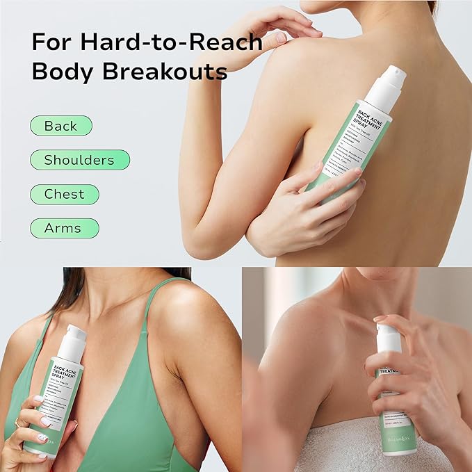 BellamiLuxx Body Acne Care Set: Butt Acne Treatment Lotion + Back & Body Acne Spray with 2% Salicylic Acid & Tea Tree Oil – Clears Breakouts, Soothes Redness & Prevents Bacne for Men, Women & Teens