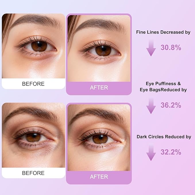 Instant Firm Under Eye Patches - Collagen Firming & Lifting Eye Masks | Reduce Puffiness, Dark Circles, Fine Lines & Wrinkles | with Hyaluronic Acid for Hydration & Firming, 8 Pair Pack1