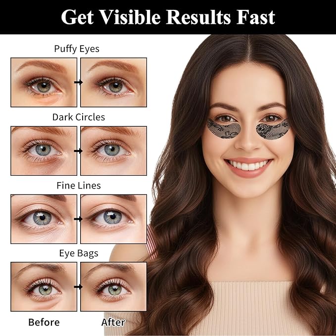 SPRINGSKY Under Eye Patches,Lace Eye Mask for Puffy Eyes and Dark Circles,Collagen Skin Care Products,Hydrating,Smoothing,Anti-Aging Eye Patch for Under Eye Bags（24 Pairs）