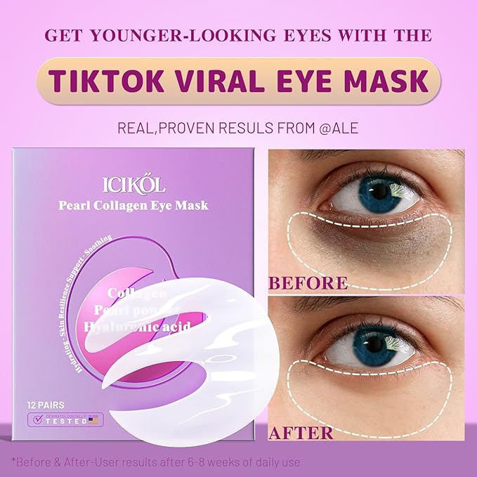 Under Eye Patches with Collagen, Eye Patches for Puffy Eyes and Dark Circles, 360° Under Eye Mask for Puffiness, Wrinkles, Fine Lines, Gifts for Women - Skin Care, 24 Pairs (White)
