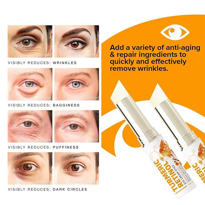 Turmeric Retinol Eye Cream Stick, Eye Balm Stick Hydrating for Dark Circles and Puffiness, Retinol Anti Aging Under Eye Cream, Reduces Fine Lines Eye Bags Eye Cream Stick for All Skin Types (2PCS)