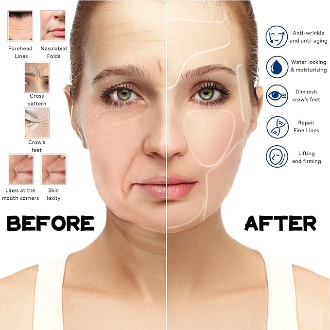Reusable Silicone Wrinkle Patches - 11-Piece Complete Set for Face, Neck, Chest, Forehead, Under Eye & Nasolabial Folds - Anti-Wrinkle Treatment for Smoothing, Firming & Hydrating Skin