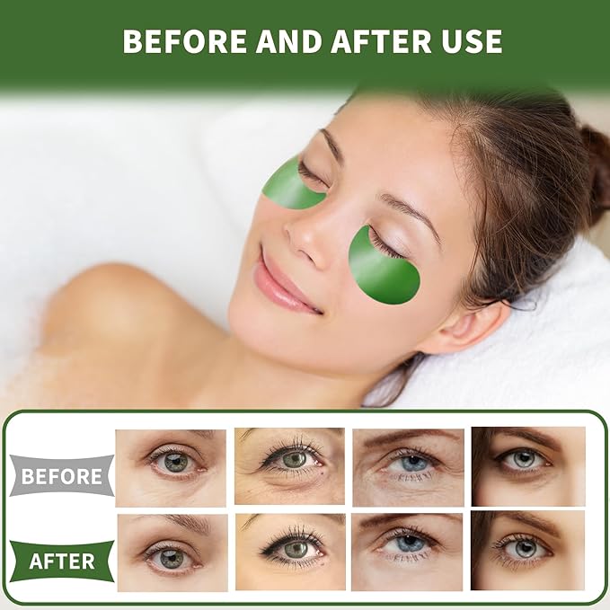 Qyiywim Under Eye Patches 70PCS, Green Tea Eye Patches for Puffy Eyes Treatment, Under Eye Masks for Dark Circles and Puffiness, Non-Irritating Eye Mask Skincare, Eye Gel Pads, Eyes Bags Treatment