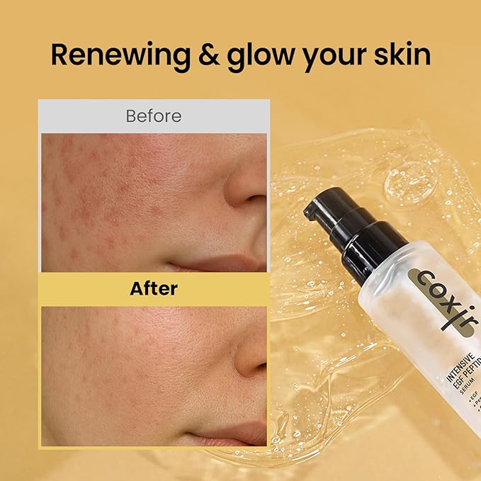 coxir INTENSIVE EGF PEPTIDES SERUM l EGF(Epidermal Growth Factor) Peptide Serum for Face – Korean Formula for Firm, Renew& Hydrated Skin – Facial Serum for Lines