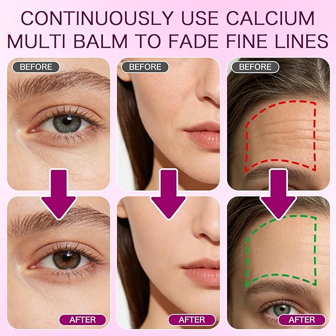 Calcium Multi Balm Stick, 2PCS Calcium Volume Multi Balm, All In One Collagen Wrinkle Stick For Face Eye Neck Lip Treatment Balm, Collagen Moisturing, Firming Skin, Anti-Aging For All Skin Type (2)