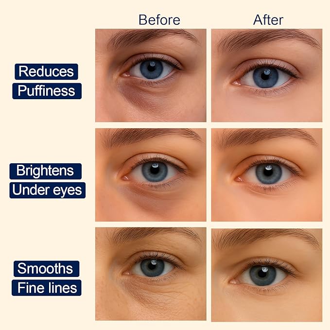 Tintark Hydrogel Under Eye Patches for Puffy Eyes & Dark Circles – 28 Pairs + 2 Eye Serums, Cooling Eye Masks with Caffeine, Vitamin C & Niacinamide for Depuffing, Brightening & Tired Eyes