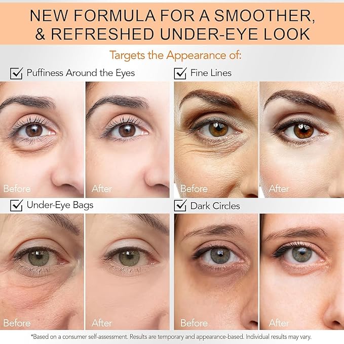 Instant Eye Tightener Cream, Under Eye Cream, Eye Cream for Puffiness and Bags Under Eyes, Retinol Eye Cream Anti Aging, Instantly Tightens and Smooths Dark Circles Wrinkles for Men & Women (2 Pack)