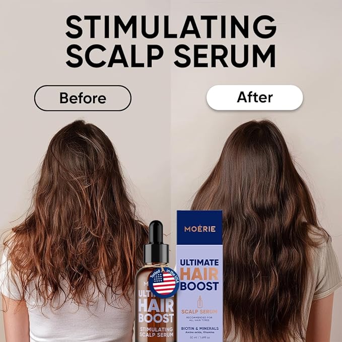 MOERIE Ultimate Hair Growth Serum for Natural Hair Regrowth & Thickening - Anti Thinning & Hair Loss Treatment for Women - Rapid Hair Growth Products (1.69 Fl Oz (Pack of 3))