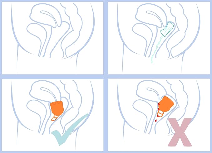 Merula Cup XL Fox – The Menstrual Cup for The Very Strong Days