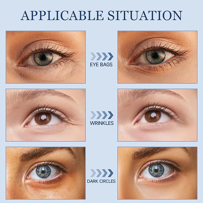 Under Eye Bags and Wrinkles, 2 Packs Eye Cream Visibly Reduces for Bags Under Eyes Bags Dark Circles Treatment for Men & Women Moisturizing Under Eye Cream