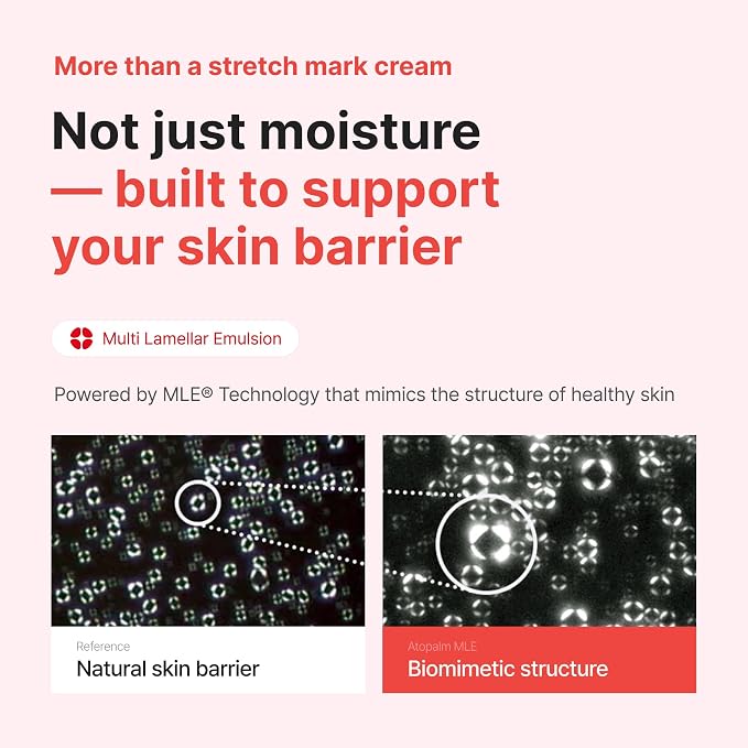 ATOPALM Maternity Care Stretch Mark Cream, 150ml 5 Fl Oz, Canola Oil Postpartum Skin Care| Pregnancy Red Lines Relief | Skin Swelling Elasticity Improvement| Gentle Body Moisturizing | Kbeauty