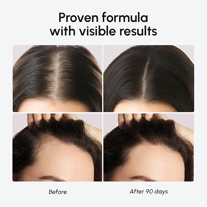 MAREE Hair Growth Serum - Caffeine Peptides Castor Rosemary Oil for Hair Growth - Products for Women & Men - Hair Oils for Hair Growth - Hair Regrowth Tonic - Scalp Serum - Suero Para El Cabello