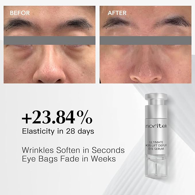 Deep Anti-Aging Wrinkle Remover & Eye Serum instantly reduces the appearance of under-eye bags, puffiness, dark circles, wrinkles, fine lines, and crow's feet
