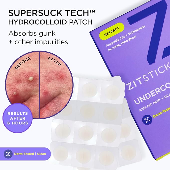 ZitSticka Undercover Invisible Pimple Patches for Face and Body - Ultra-Thin Hydrocolloid Acne Patches for Zits & Blemishes - Fast-Acting & Effective - 108 Count