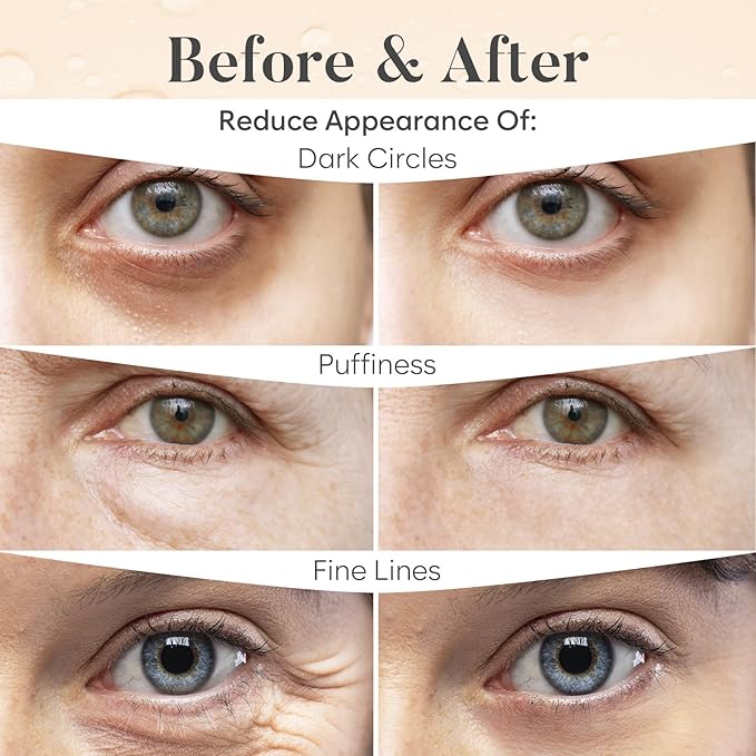 AURAE Variety Under Eye Patches (30 Pairs) - For Dark Circles & Puffiness - Eye Mask for Care