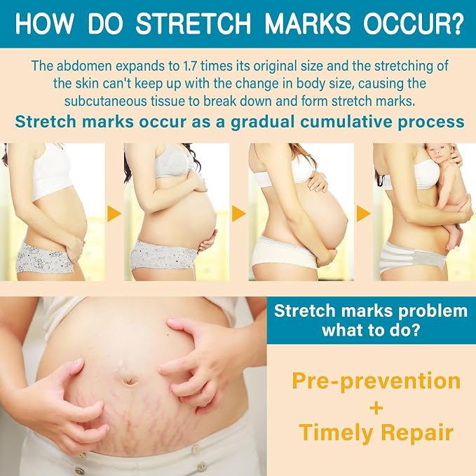 Stretch Mark Cream for Pregnancy & Postpartum,with Argan Oil, Shea Butter & Vitamin E,Stretch Mark Prevention for Belly,Moisturize Skin,Prevent & Fade stretch marks (300ml_1PACK)