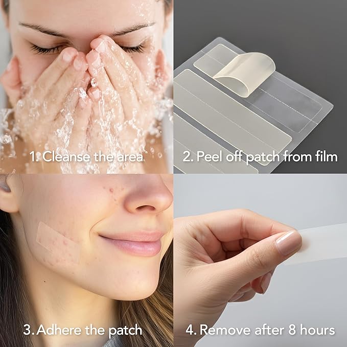 Saplaya K-Beauty Hydrocolloid Ance Area Care Hydrocolloid Patches For Acne Pimple Care 100% Hydrocolloid Acne Spot Healing Patch